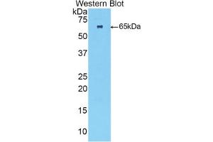 Detection of Recombinant TNNC2, Human using Polyclonal Antibody to Troponin C Type 2, Fast (TNNC2) (TNNC2 抗体  (AA 2-160))