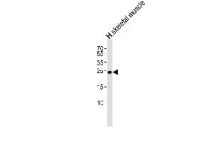 Western blot analysis of lysate from human skeletal muscle tissue lysate, using TME Antibody (N-term) (ABIN6244271 and ABIN6577475). (TMEM239 抗体  (N-Term))