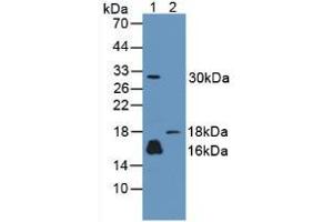 Western blot analysis of (1) Human A431 Cells and (2) Rat Skin Tissue. (CALML3 抗体  (AA 1-149))