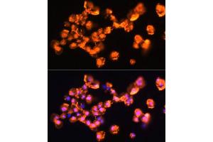 Immunofluorescence analysis of  cells using PRKCB antibody (ABIN6128463, ABIN6146200, ABIN6146202 and ABIN6221544) at dilution of 1:100. (PKC beta 抗体  (AA 220-340))