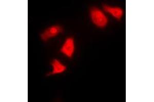 Immunofluorescent analysis of CHK1 staining in HeLa cells. (CHEK1 抗体  (Center))
