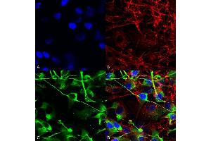 Immunocytochemistry/Immunofluorescence analysis using Mouse Anti-GluN2A/NR2A Monoclonal Antibody, Clone S327-95 (ABIN2483884). (NMDAR2A 抗体  (AA 75-325) (PE))