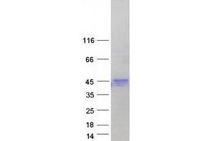 Western Blotting (WB) image for Hemochromatosis (HFE) (Transcript Variant 6) protein (Myc-DYKDDDDK Tag) (ABIN2722685)