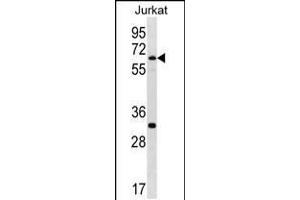 Western blot analysis in Jurkat cell line lysates (35ug/lane). (SMARCD1 抗体  (C-Term))