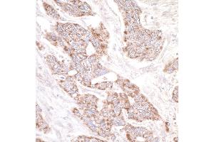 Immunohistochemistry (IHC) image for anti-Rap Guanine Nucleotide Exchange Factor (GEF) 2 (RAPGEF2) (AA 975-1025) antibody (ABIN7453596)