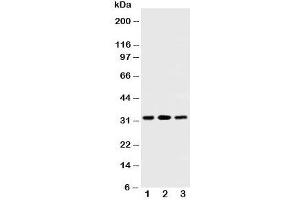 Western Blotting (WB) image for anti-Succinate Dehydrogenase Complex, Subunit B, Iron Sulfur (Ip) (SDHB) (AA 42-59) antibody (ABIN3032764)