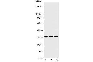 Western blot testing of SDHB antibody and Lane 1:  rat testis;  2: rat heart;  3: Jurkat cell lysate. (SDHB 抗体  (AA 42-59))