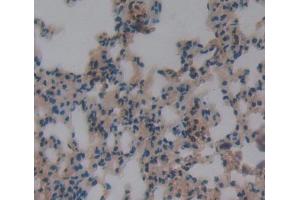 IHC-P analysis of lung tissue, with DAB staining. (DOK3 抗体  (AA 160-409))