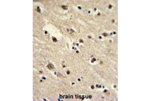 Immunohistochemistry (IHC) image for anti-Eukaryotic Translation Elongation Factor 1 alpha 1 (EEF1A1) antibody (ABIN3002704) (eEF1A1 抗体)
