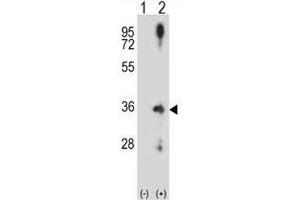 Western blot analysis of Cyclin D2 antibody and 293 cell lysate (2 ug/lane) either nontransfected (Lane 1) or transiently transfected (2) with the CCND2 gene. (Cyclin D2 抗体  (AA 1-30))