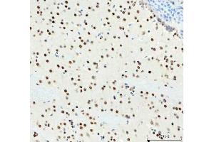 IHC analysis of DDX1 using anti-DDX1 antibody (ABIN7602052). (DDX1 抗体  (AA 562-740))