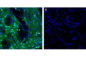 anti-Tachykinin Receptor 2 (TACR2) (AA 351-367), (Intracellular), (N-Term) antibody