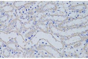 Immunohistochemistry of paraffin-embedded Mouse kidney using AQP5 Polyclonal Antibody at dilution of 1:50 (40x lens). (Aquaporin 5 抗体)