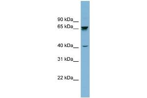 WB Suggested Anti-ACHE Antibody Titration: 0. (Acetylcholinesterase 抗体  (Middle Region))