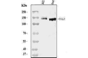 Western blot analysis of Desmoglein 3/PVA/DSG3 using anti-Desmoglein 3/PVA/DSG3 antibody (ABIN7601560).