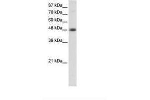 Image no. 1 for anti-Transcription Factor AP-2 beta (Activating Enhancer Binding Protein 2 Beta) (TFAP2B) (AA 372-421) antibody (ABIN202550)