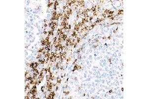 Immunohistochemistry of paraffin-embedded Human tonsil using CD7 antibody (ABIN7266214) at dilution of 1:10000 (40x lens). (CD7 抗体)