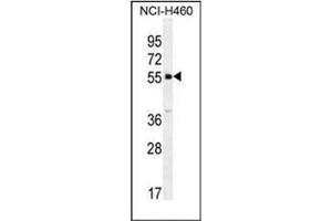 Western blot analysis of SHISA6 Antibody (N-term) in NCI-H460 cell line lysates (35ug/lane). (SHISA6 抗体  (N-Term))