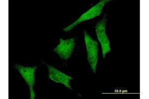 Immunofluorescence of purified MaxPab antibody to RIOK2 on HeLa cell. (RIOK2 抗体  (AA 1-552))