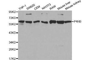 Western blot analysis of extracts of various cell lines, using P4HB antibody. (P4HB 抗体)