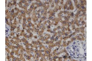 Immunoperoxidase of monoclonal antibody to MCCC2 on formalin-fixed paraffin-embedded human liver. (MCCC2 抗体  (AA 456-563))
