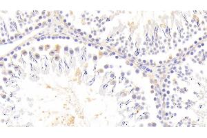 Immunohistochemistry (IHC) image for anti-Sirtuin 4 (SIRT4) (AA 60-255) antibody (ABIN7437602)