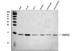 Western blot analysis of SNRPD2 using anti-SNRPD2 antibody (ABIN7598963).
