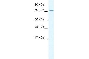 WB Suggested Anti-TGFB1I1 Antibody Titration: 0. (TGFB1I1 抗体  (Middle Region))