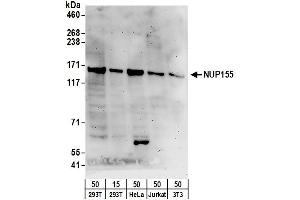 anti-Nucleoporin 155kDa (NUP155) (AA 1341-1391) antibody