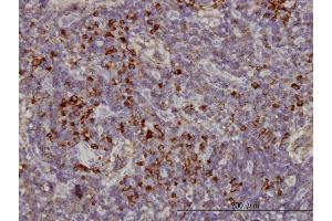 Immunoperoxidase of monoclonal antibody to KIFC1 on formalin-fixed paraffin-embedded human lymph node. (KIFC1 抗体  (AA 53-152))