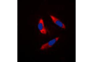 Immunofluorescent analysis of S6K1 staining in Hela cells.
