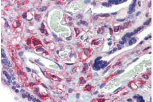 Placenta, Human: Formalin-Fixed, Paraffin-Embedded (FFPE) (KIF20A 抗体  (C-Term))