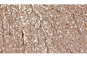 Detection of GFAP in Rat Spinal cord Tissue using Polyclonal Antibody to Glial Fibrillary Acidic Protein (GFAP) (GFAP 抗体  (AA 1-430))