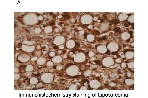Immunohistochemistry (IHC) image for anti-Cytochrome P450, Family 26, Subfamily A, Polypeptide 1 (CYP26A1) (C-Term) antibody (ABIN307114)