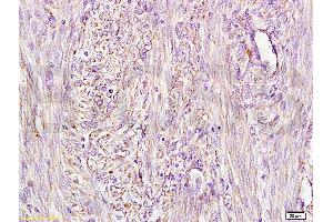 Immunohistochemistry (IHC) image for anti-alpha-Fetoprotein (AFP) antibody (ABIN722916) (alpha Fetoprotein 抗体)