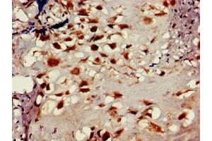 Immunohistochemistry of paraffin-embedded human placenta tissue using ABIN7158837 at dilution of 1:100 (LOXL2 抗体  (AA 27-121))