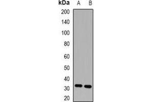 Western blot analysis of HUS1 expression in K562 (A), HEK293T (B) whole cell lysates. (HUS1 抗体)