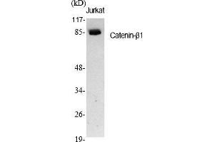 Western Blot analysis of various cells using Catenin-β1 Polyclonal Antibody diluted at 1:1000. (CTNNB1 抗体  (AA 600-680))