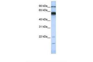 Image no. 1 for anti-Matrix Metallopeptidase 16 (Membrane-inserted) (MMP16) (AA 72-121) antibody (ABIN6738261) (MMP16 抗体  (AA 72-121))