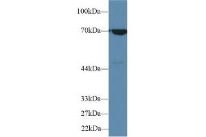 Detection of HSPA1B in Human A549 cell lysate using Polyclonal Antibody to Heat Shock 70 kDa Protein 1B (HSPA1B) (HSPA1B 抗体  (AA 1-642))
