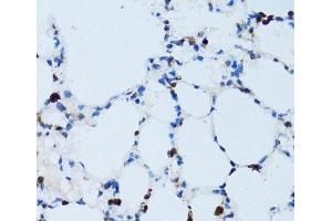 Immunohistochemistry of paraffin-embedded Mouse lung using SPN Polyclonal Antibody at dilution of 1:100 (40x lens). (CD43 抗体)