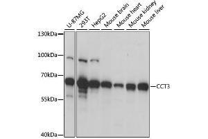Western blot analysis of extracts of various cell lines, using CCT3 antibody. (CCT3 抗体  (AA 1-300))