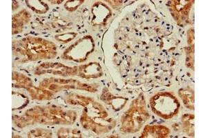 Immunohistochemistry of paraffin-embedded human kidney tissue using ABIN7175855 at dilution of 1:100 (WISP3 抗体  (AA 201-372))
