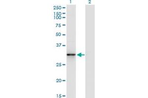 Western Blot analysis of CDK5 expression in transfected 293T cell line by CDK5 monoclonal antibody (M01A), clone 1A2. (CDK5 抗体  (AA 195-292))