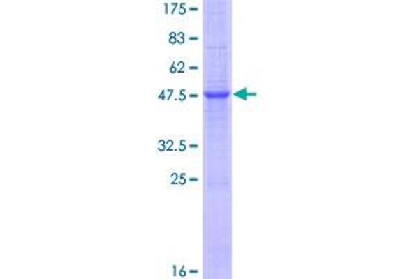 IL-19 Protein (AA 1-215) (GST tag)