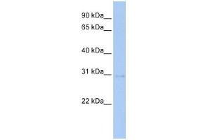 STK16 antibody used at 1 ug/ml to detect target protein. (STK16 抗体  (Middle Region))