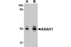 Western blot analysis of ASAH1 in mouse heart tissue lysate with ASAH1 antibody at (A) 1 and (B) 2 μg/ml. (ASAH1 抗体  (C-Term))