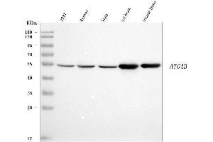 Western blot analysis of ATG4B using anti-ATG4B antibody (ABIN7600261).