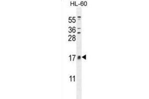 Western Blotting (WB) image for anti-Cornichon Homolog 2 (CNIH2) antibody (ABIN2996238)