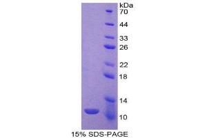 SDS-PAGE (SDS) image for Indoleamine 2,3-Dioxygenase (IDO) (AA 276-360) protein (His tag) (ABIN1170681)